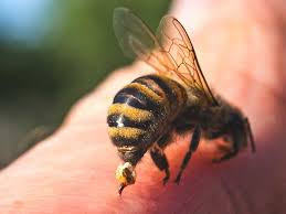 1639719765 360 ¿Suenas Una picadura de abeja en la cara Publicacion