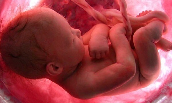 ¿Qué significa soñar con aborto espontáneo? 31 que significa soñar con aborto