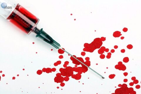 ¿Qué significa soñar que se tiene SIDA? 6 ¿Qué significa soñar que se tiene SIDA?